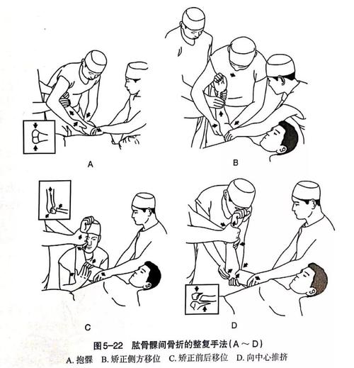 骨头镇操作有哪些技巧？这些技巧让你事半功倍！