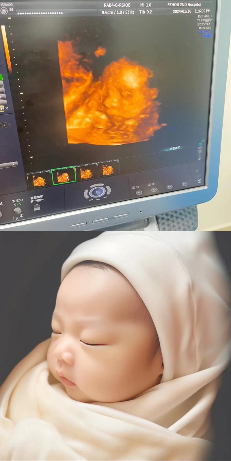 预测宝宝长相的秘密：基因遗传与AI技术的结合