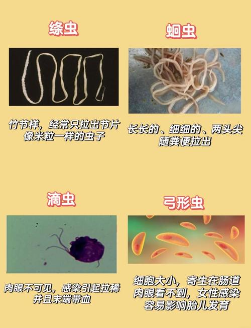 内部寄生虫版本大全哪个好?热门版本大对比推荐!